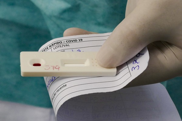 Piauí tem recorde de mil novos casos de Covid e chega a 35 óbitos em dois dias