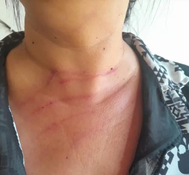 Mãe de aluno é agredida por professora dentro da escola no povoado Curral de Pedras.